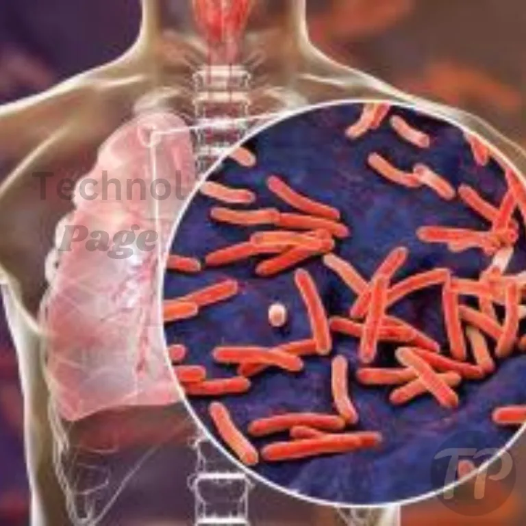 What is Tuberculosis
