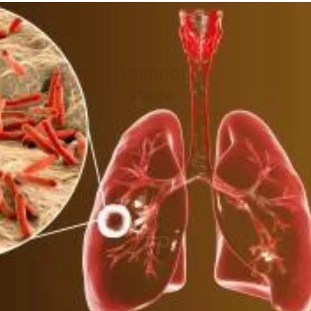 What is Tuberculosis