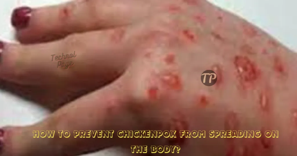 What is smallpox, Symptoms, Causes, Diagnosis and Treatment