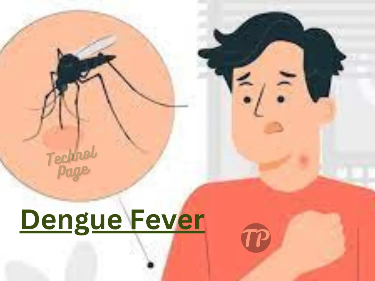 Dengue Fever, Causes, Symptoms, Diagnosis and Treatment